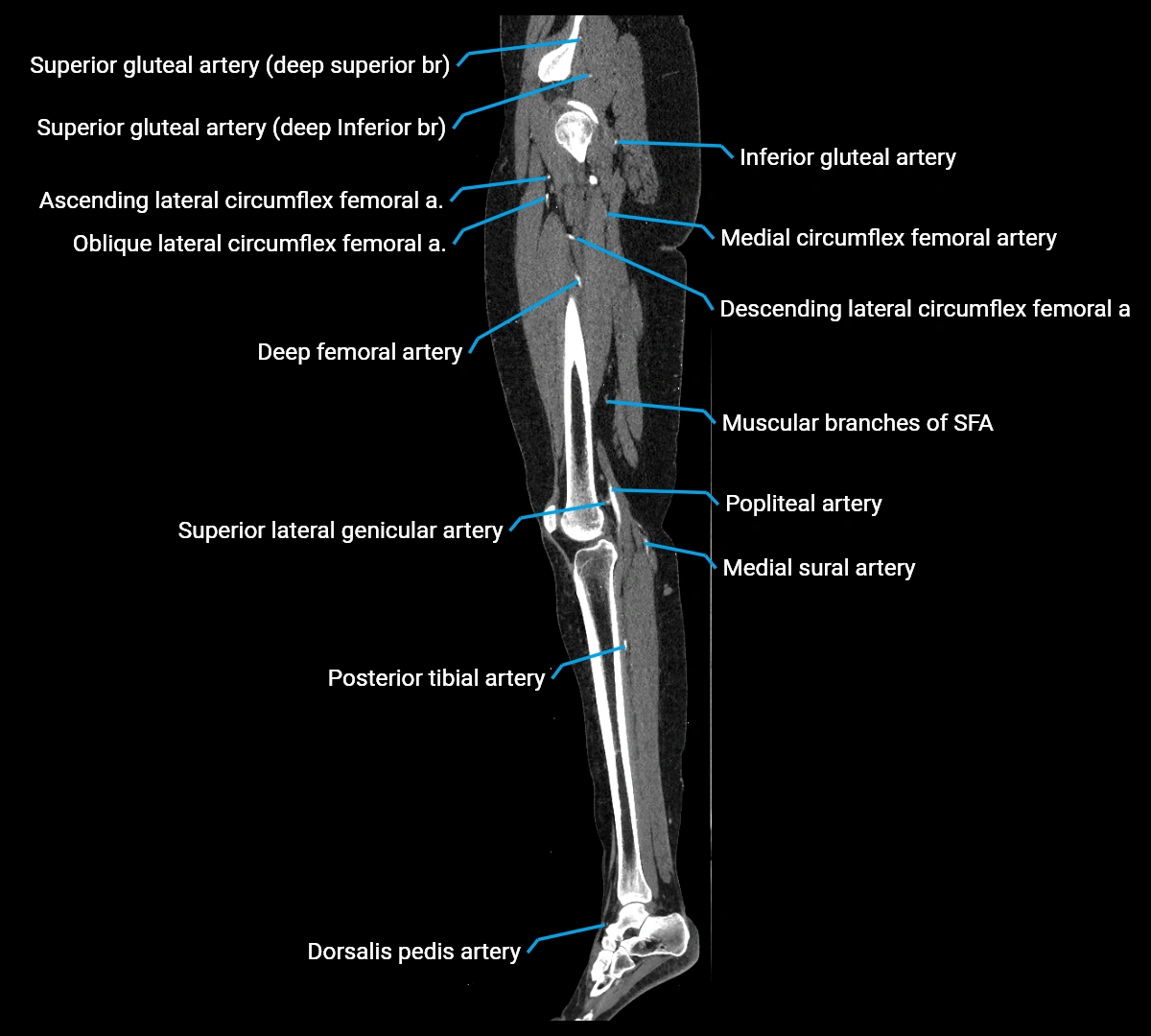 CTA lower limb sagittal cross sectional anatomy labelled image _44 (3).webp